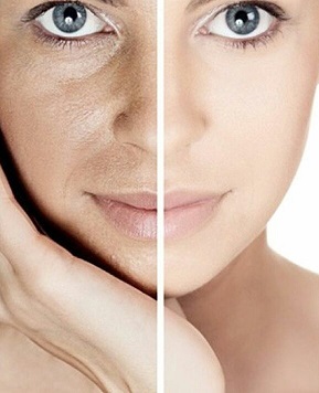 Dry Skin or Dehydrated Skin? What's the Difference? - Halea's Blog